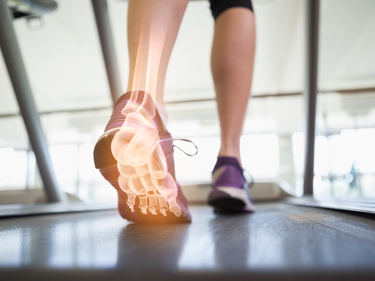 외상/스포츠 손상