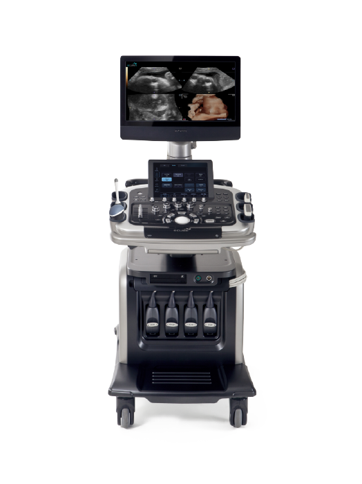 초음파 검사장비